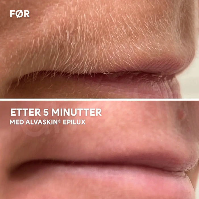 2-i-1 epilator og barbermaskin | Vanntett for bruk i dusjen - Overrask.no