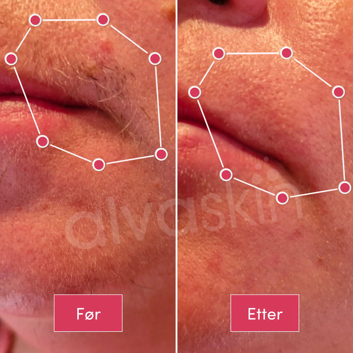 2-i-1 epilator og barbermaskin | Vanntett for bruk i dusjen - Overrask.no