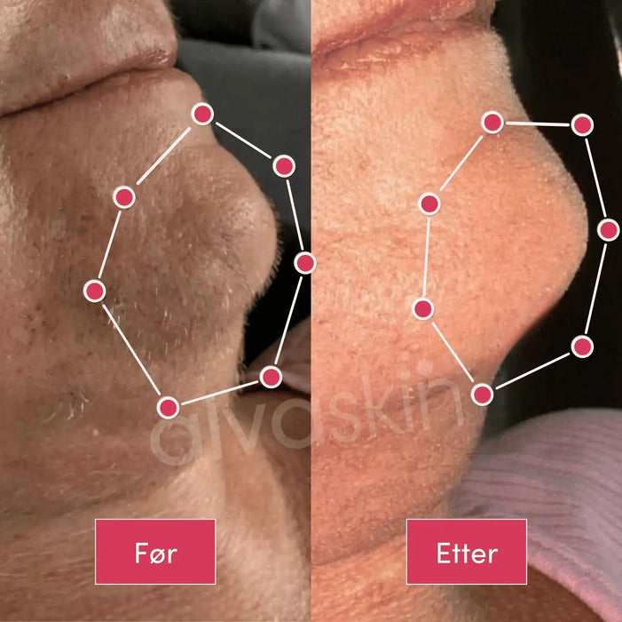 2-i-1 epilator og barbermaskin | Vanntett for bruk i dusjen - Overrask.no