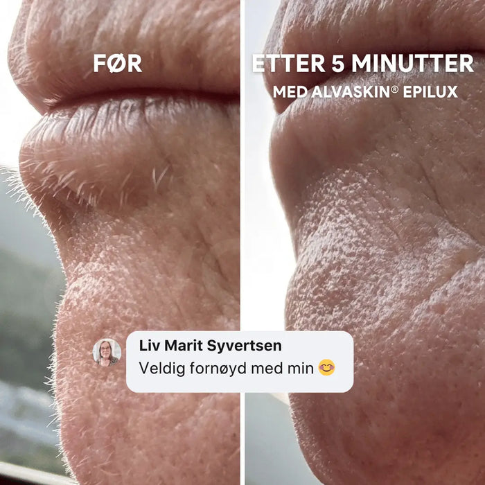 2-i-1 epilator og barbermaskin | Vanntett for bruk i dusjen - Overrask.no