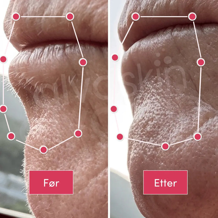 2-i-1 epilator og barbermaskin | Vanntett for bruk i dusjen - Overrask.no