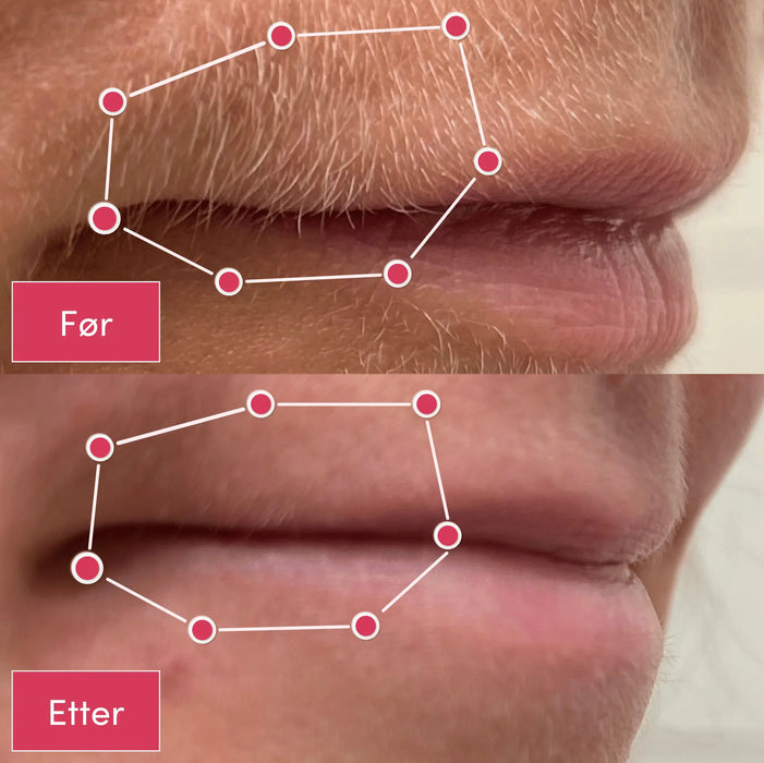 2-i-1 epilator og barbermaskin | Vanntett for bruk i dusjen - Overrask.no