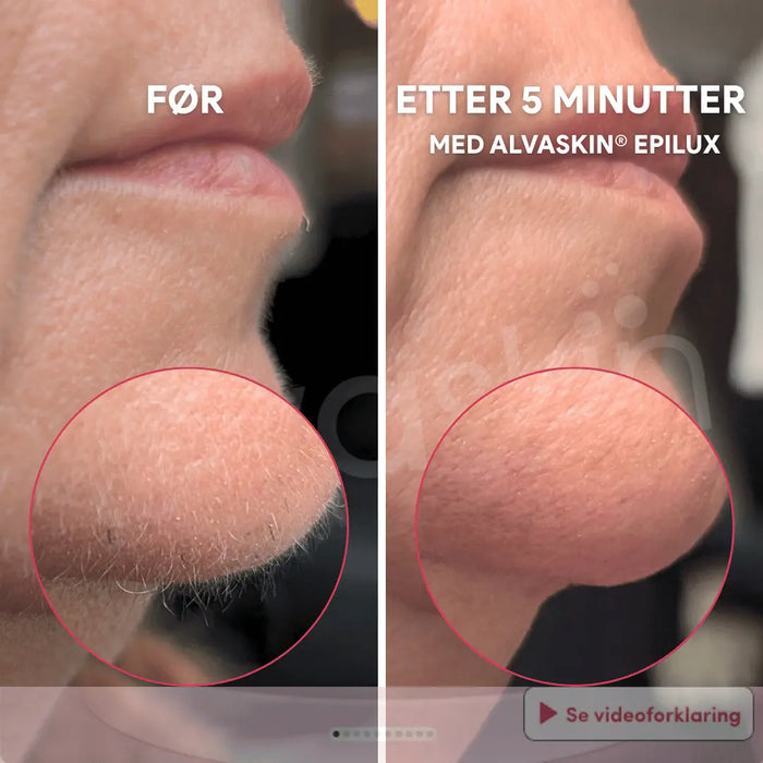 2-i-1 epilator og barbermaskin | Vanntett for bruk i dusjen - Overrask.no
