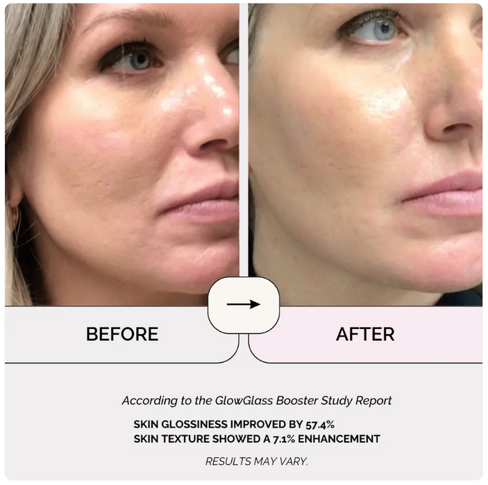 Anti-aging booster med infrarød lysterapi og face facelift