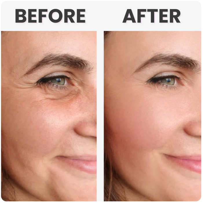 Anti-aging booster med infrarød lysterapi og face facelift