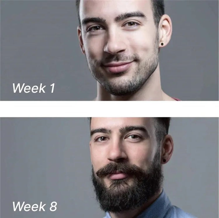Refil skjeggvekst serum / Beard Growth Kit med Serum 30ml